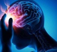 أسرع علاج للجلطة الدماغية