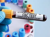 ما هو تحليل cbc
