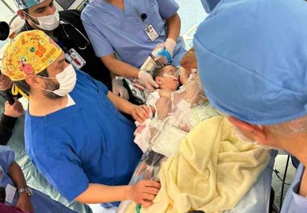 نجاح عملية فصل التوأم السيامي العراقي