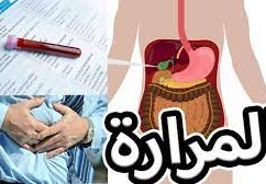 اعراض التهاب المرارة وطرق علاجه