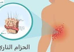 ما هو الحزام الناري