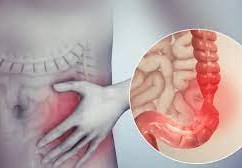 أعراض القولون العصبي عند النساء