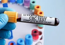ما هو تحليل cbc