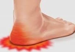 اعراض النقرص