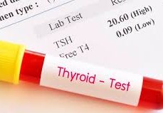 ما هو تحليل tsh